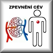 Zpevnění cév